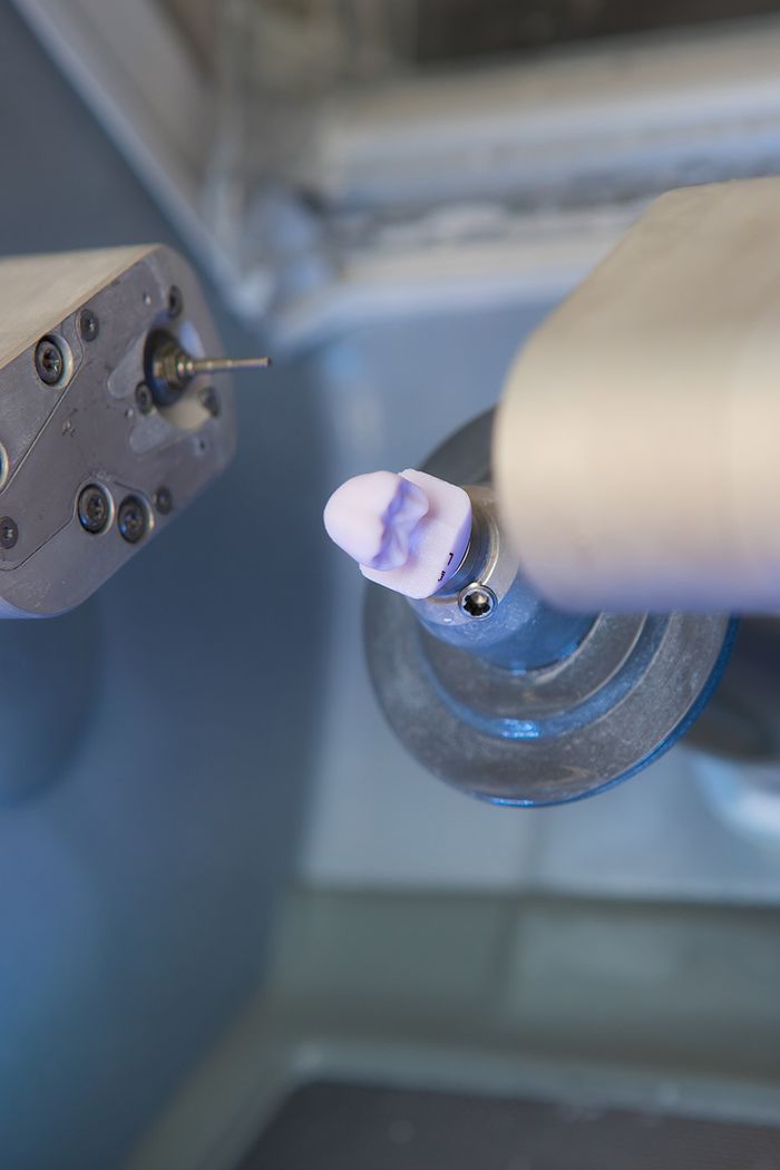 Get Real-Time Results With CEREC