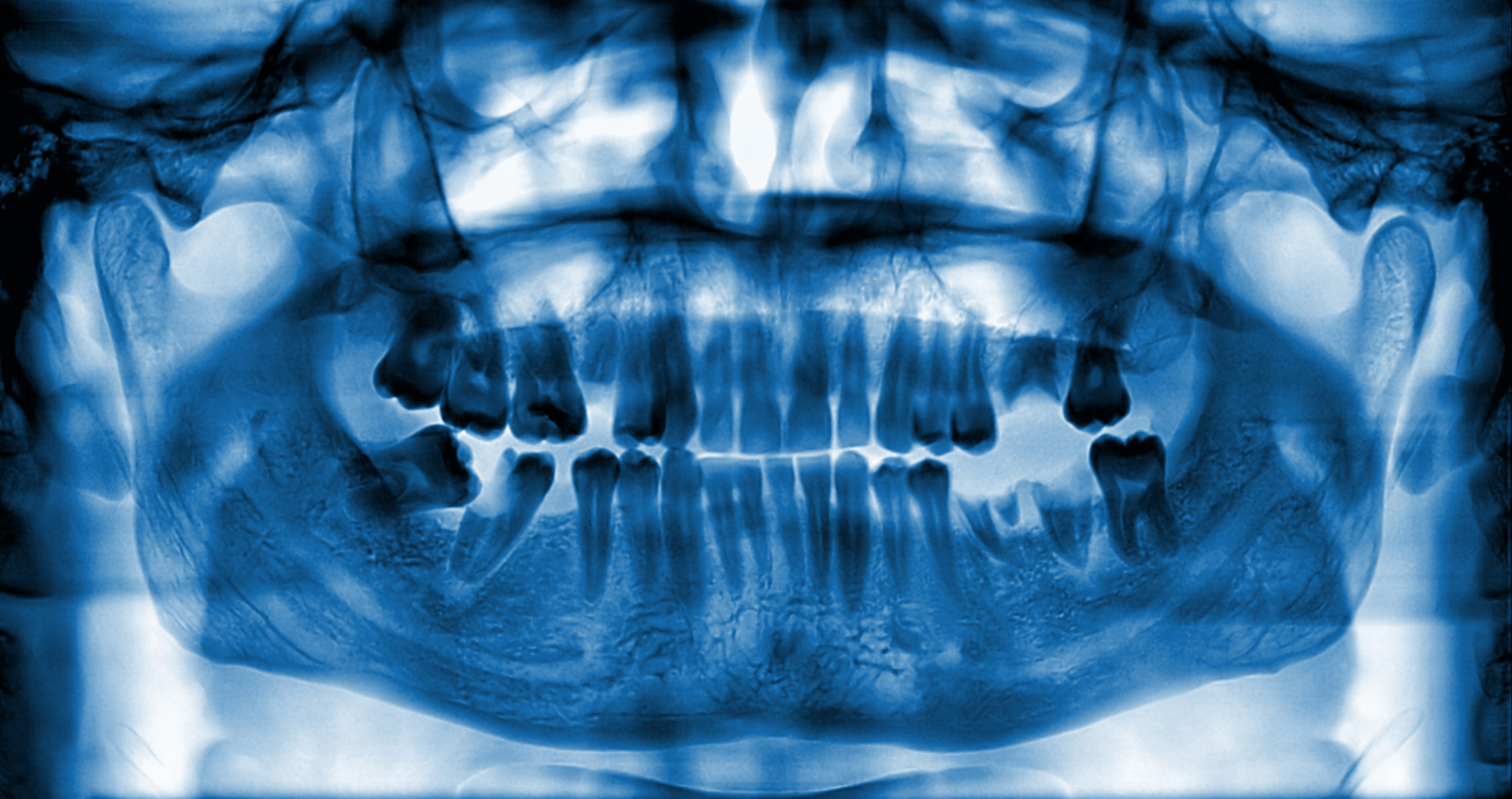 ridge augmentation in Franklin