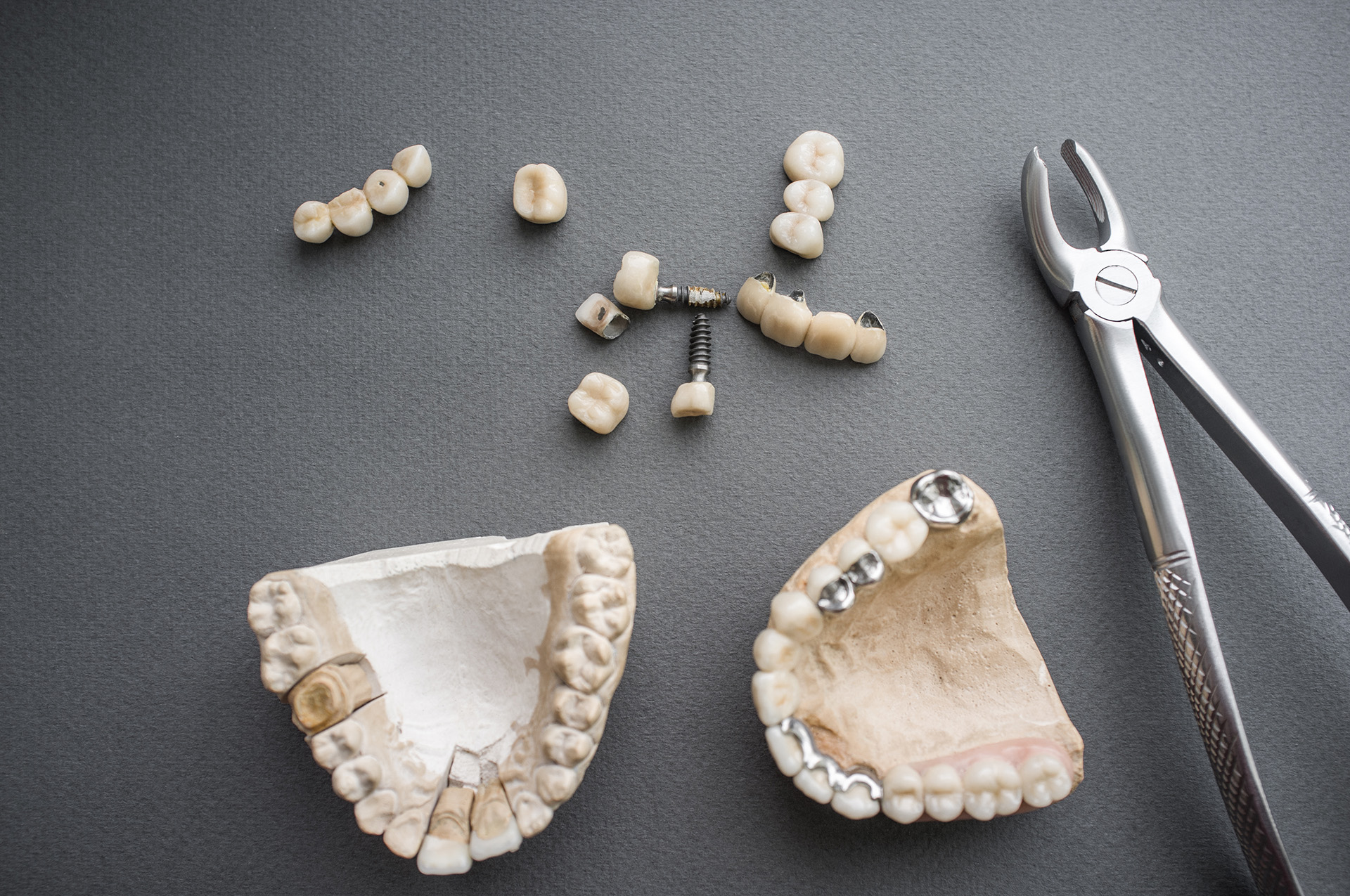 Franklin implant preparation