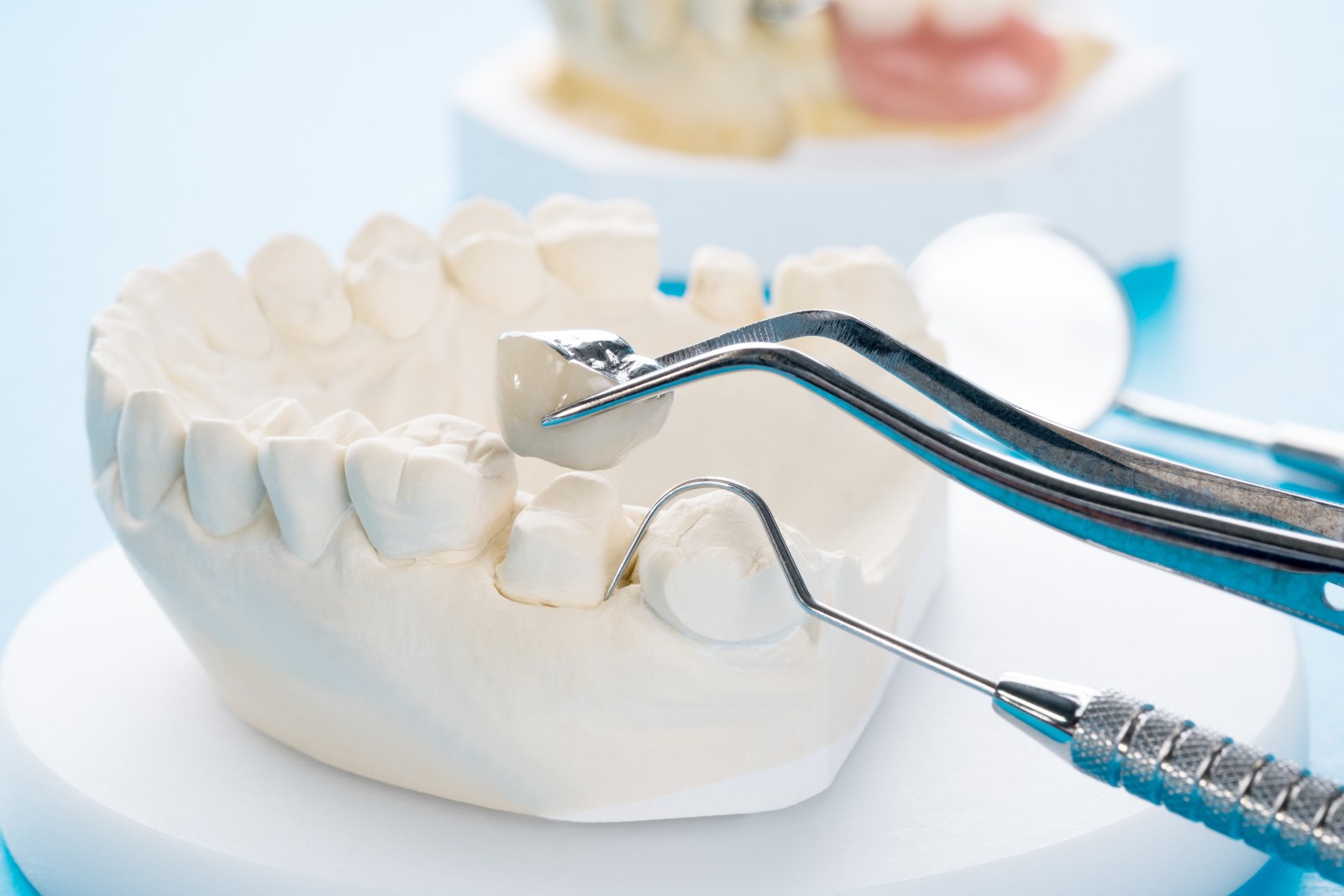 dental crowns in Franklin