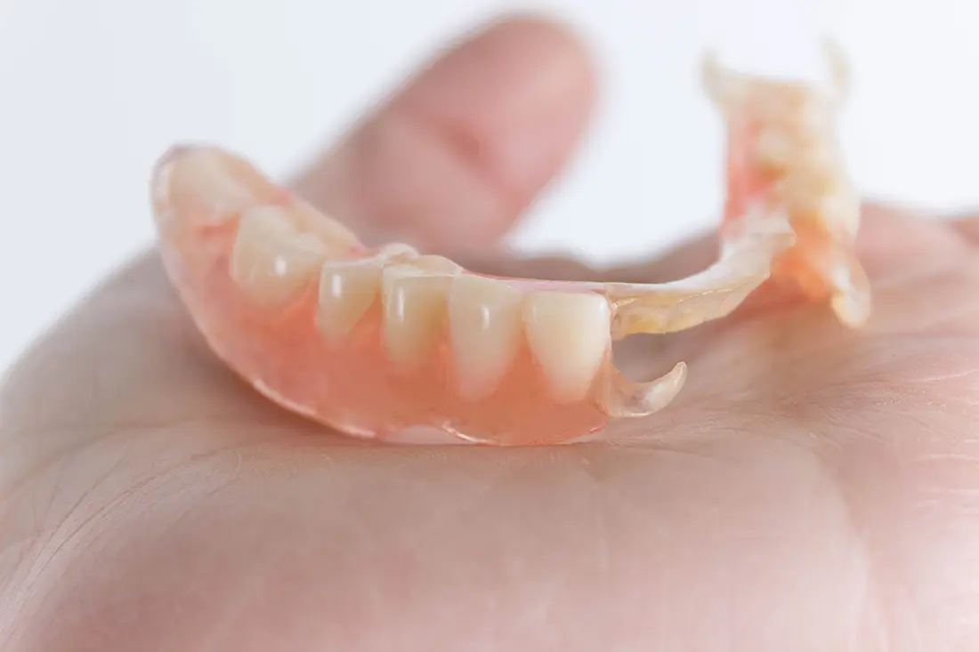 Valplast Dentures