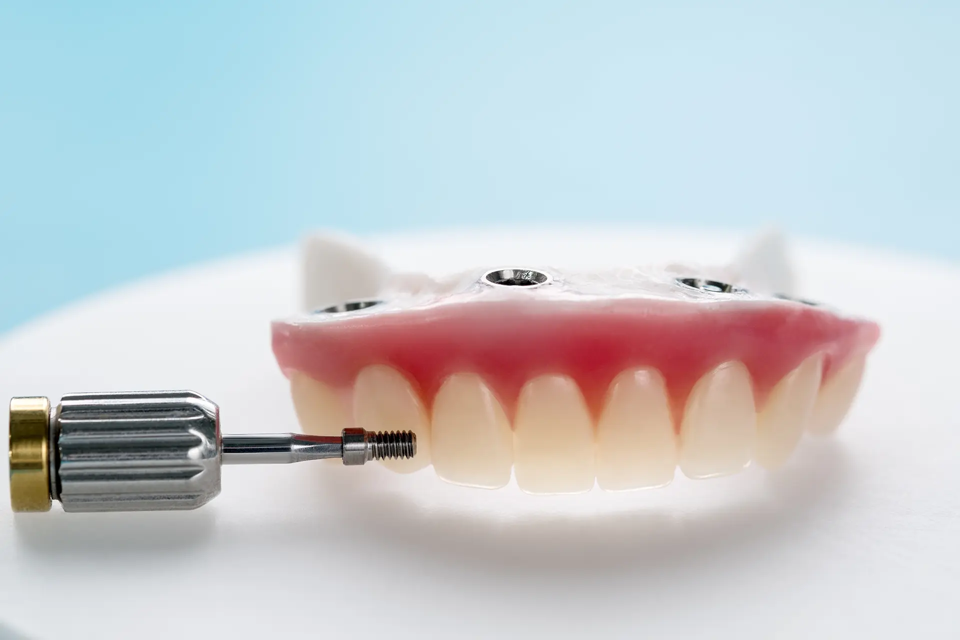 implant retained dentures Franklin