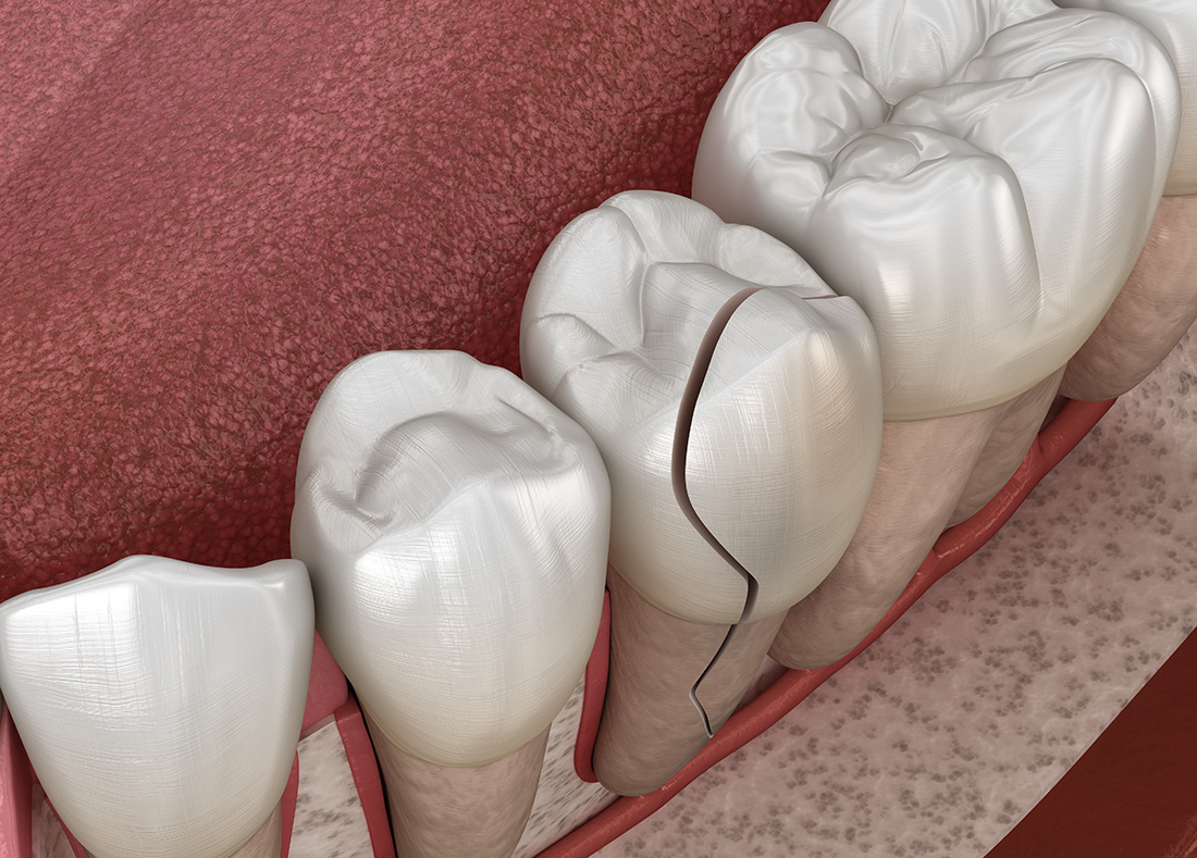 emergency dentist in Franklin