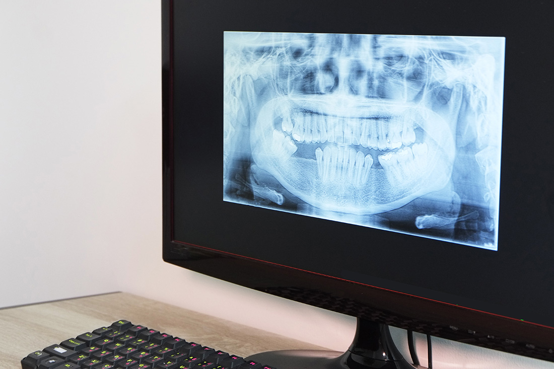 Digital X-Rays