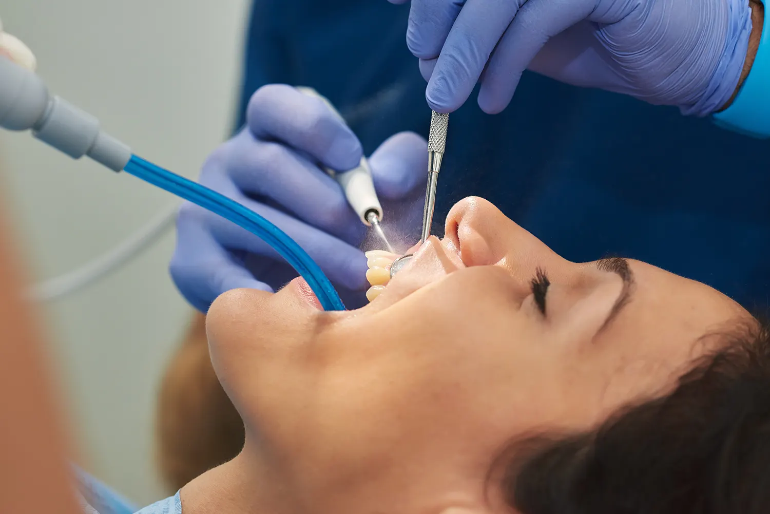 Dental Cleanings in Franklin