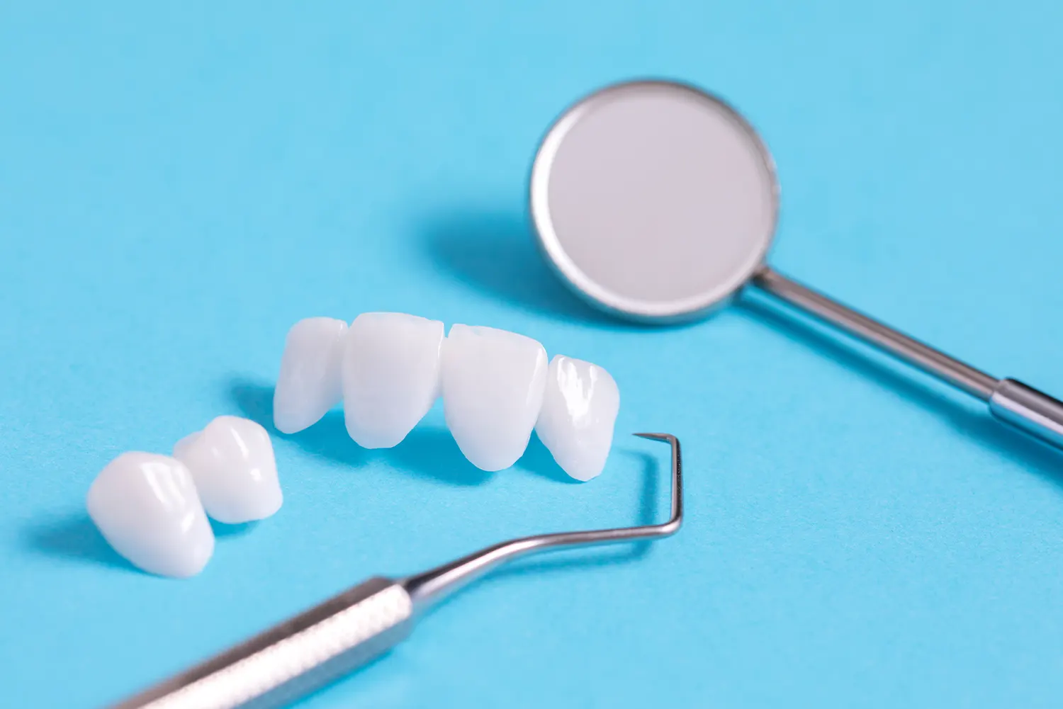 Can You Go Back To Normal Teeth After Getting Veneers?