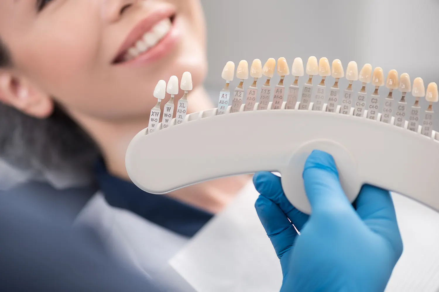 How to Take Care of Veneers