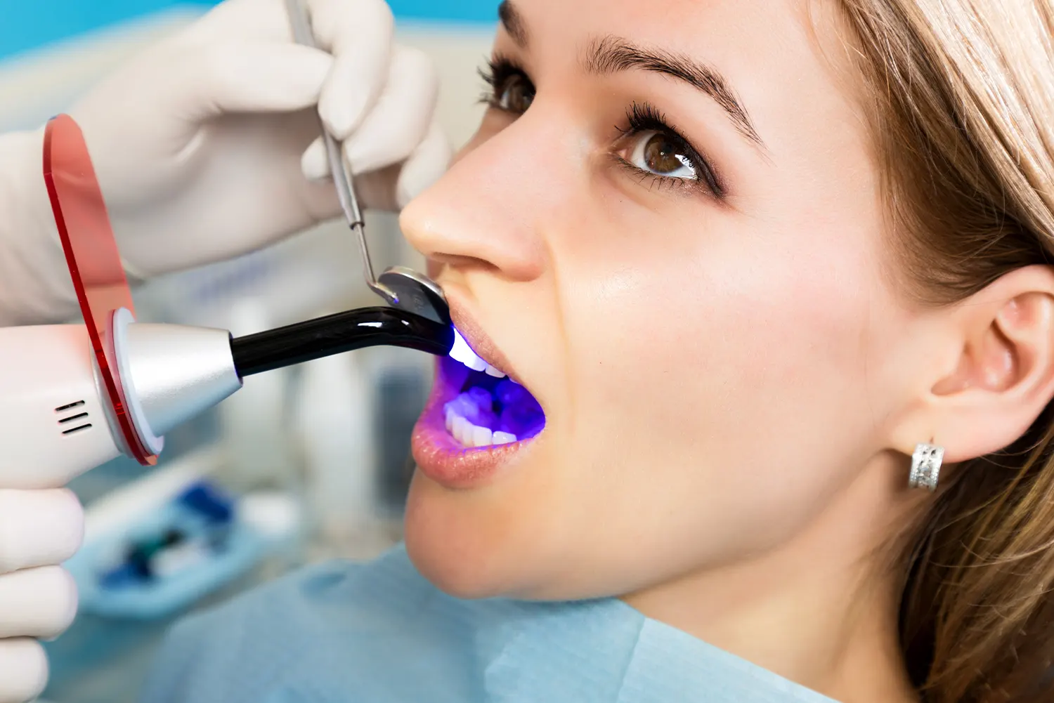 Dental Bonding in Franklin