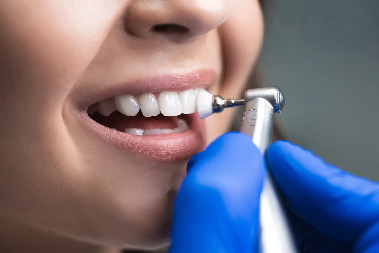 Dental Cleanings